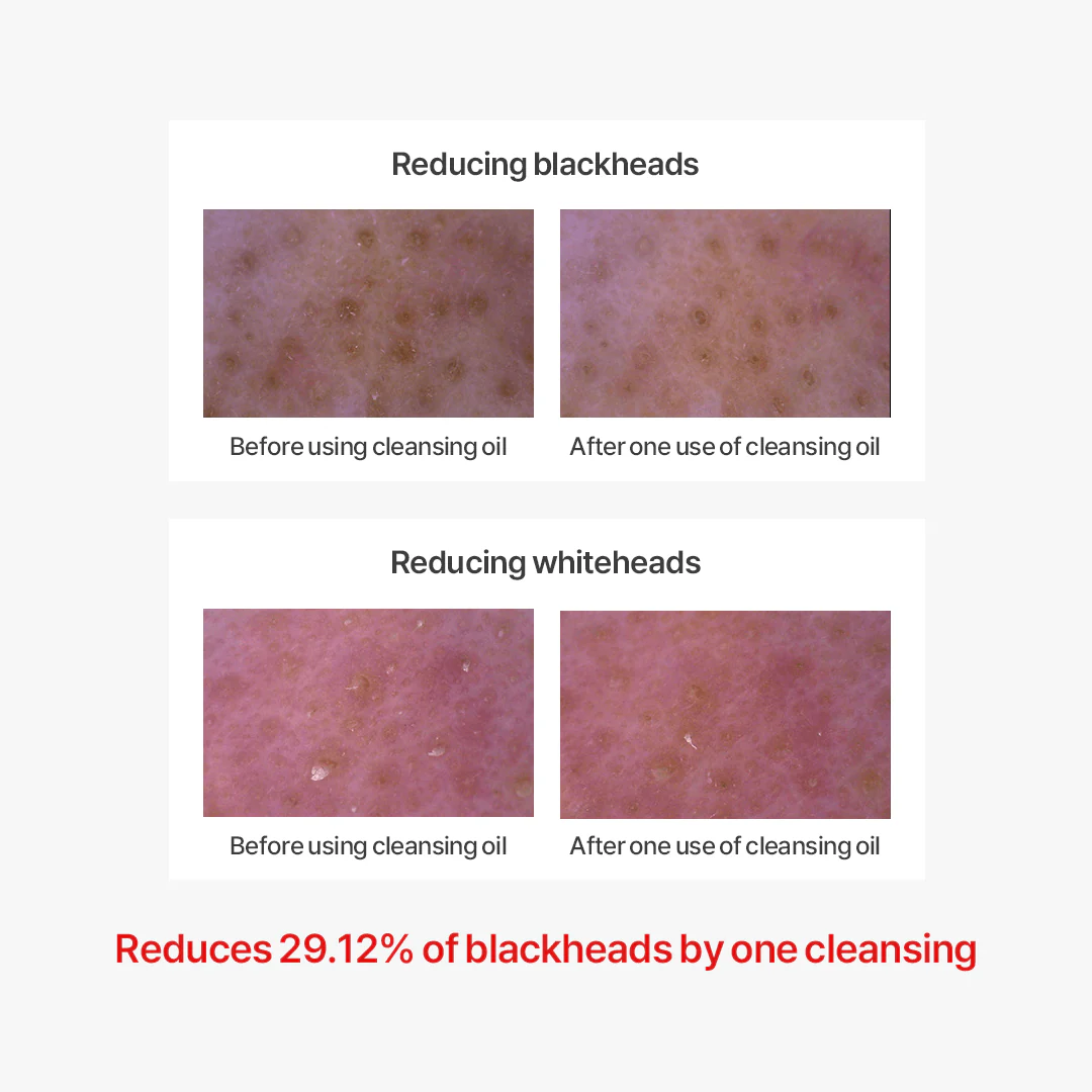 Thank You Farmer Pollufree™ Cleansing Oil - 200ml - Image 6