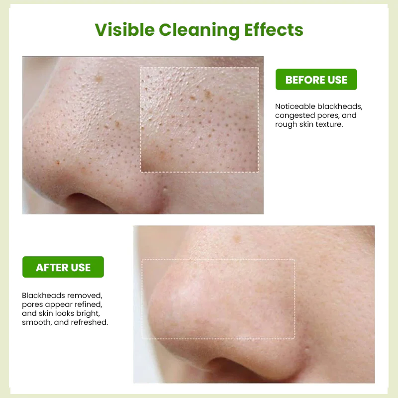 Sungboon Editor Green Tomato Deep Pore Cleansing Tissue (50g, 10pcs) - Image 5