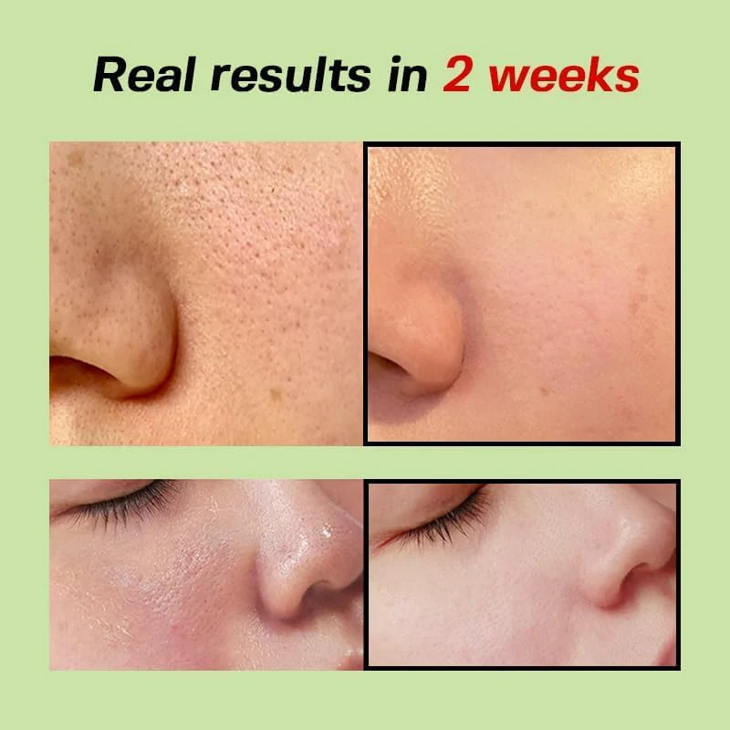 Sungboon Editor Green Tomato Pore Lifting Ampoule+ (75ml) - Image 3